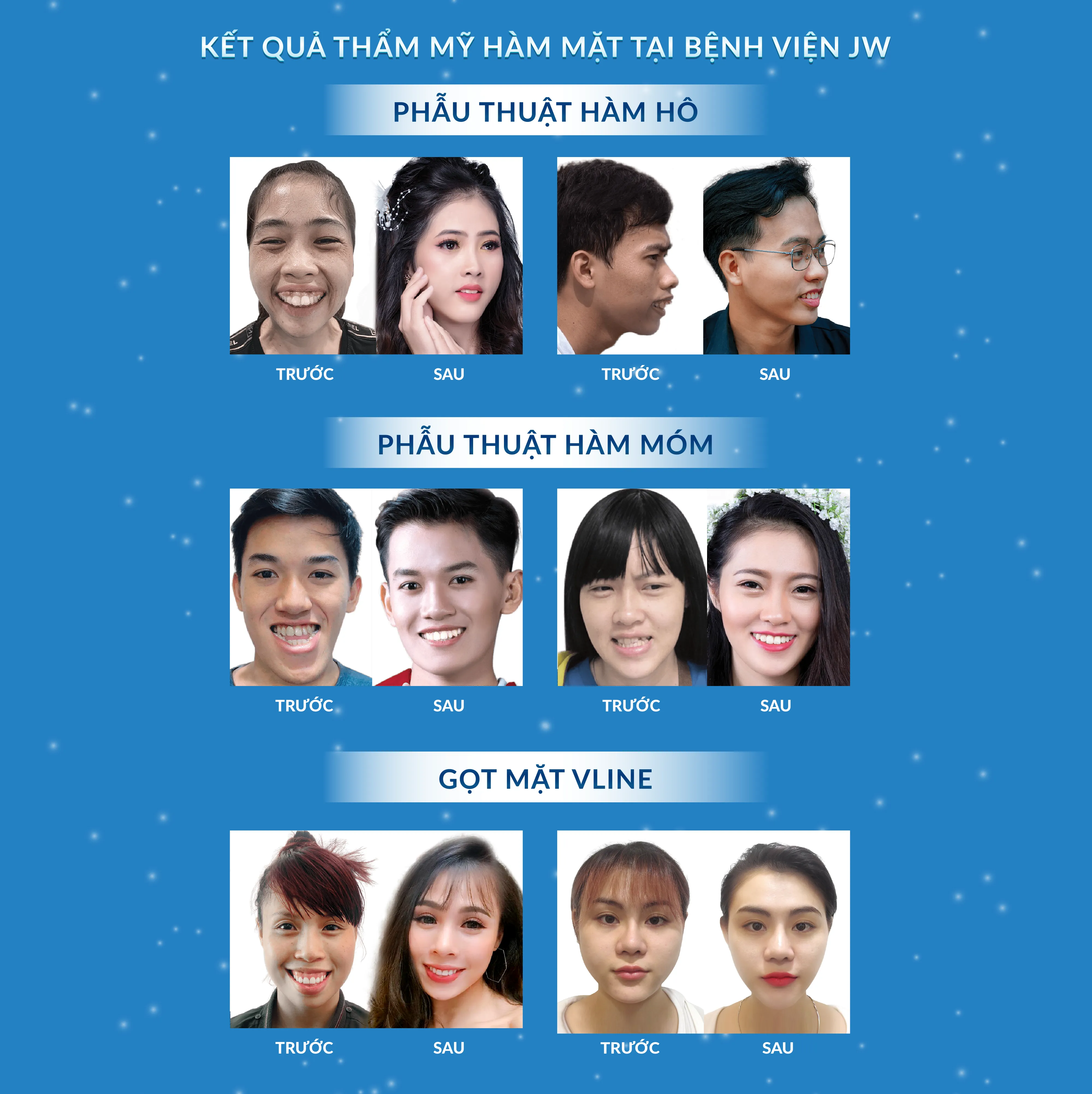 Thẩm Mỹ Hàm Mặt