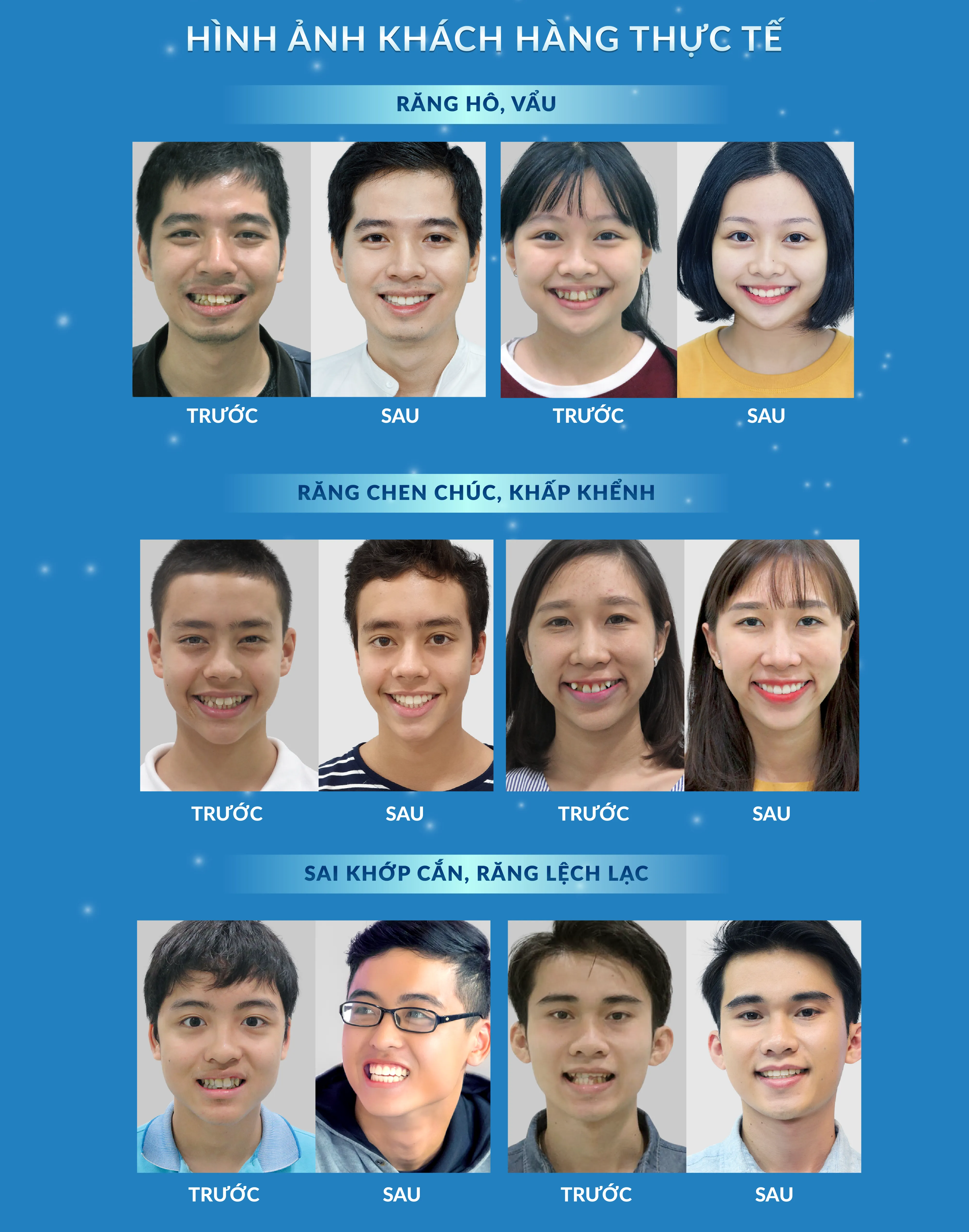 Niền Răng Trong Suốt AI