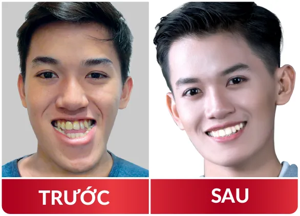 Thẩm Mỹ Hàm Mặt 2023