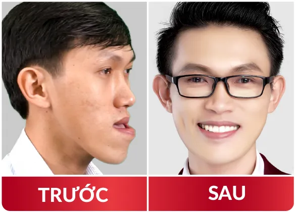 Thẩm Mỹ Hàm Mặt 2023