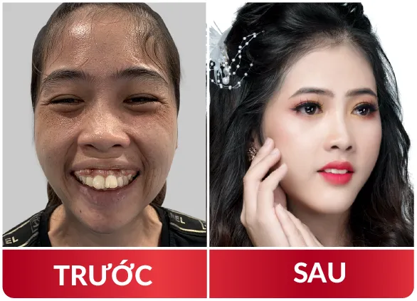 Thẩm Mỹ Hàm Mặt 2023