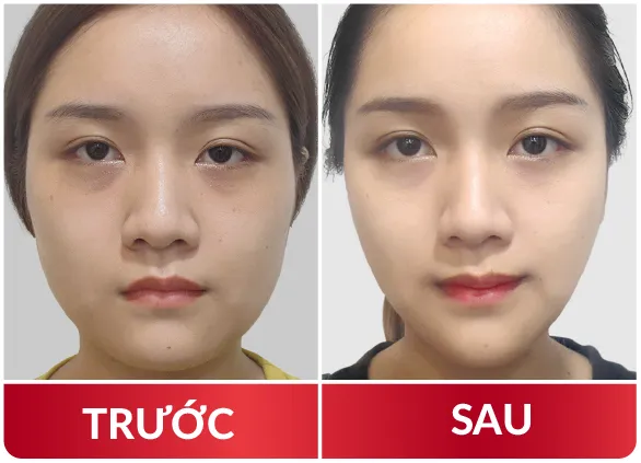 Thẩm Mỹ Hàm Mặt 2023