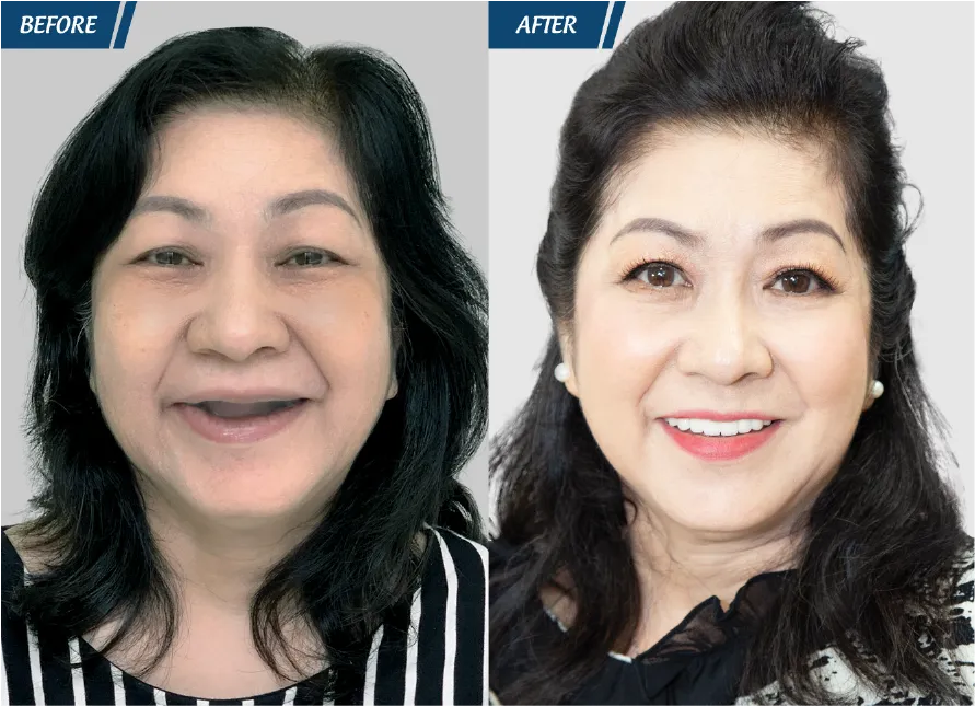 Răng Đẹp Đón Tết 2024