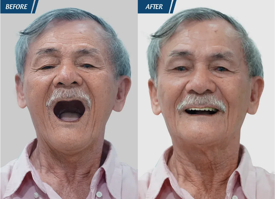 Răng Đẹp Đón Tết 2024