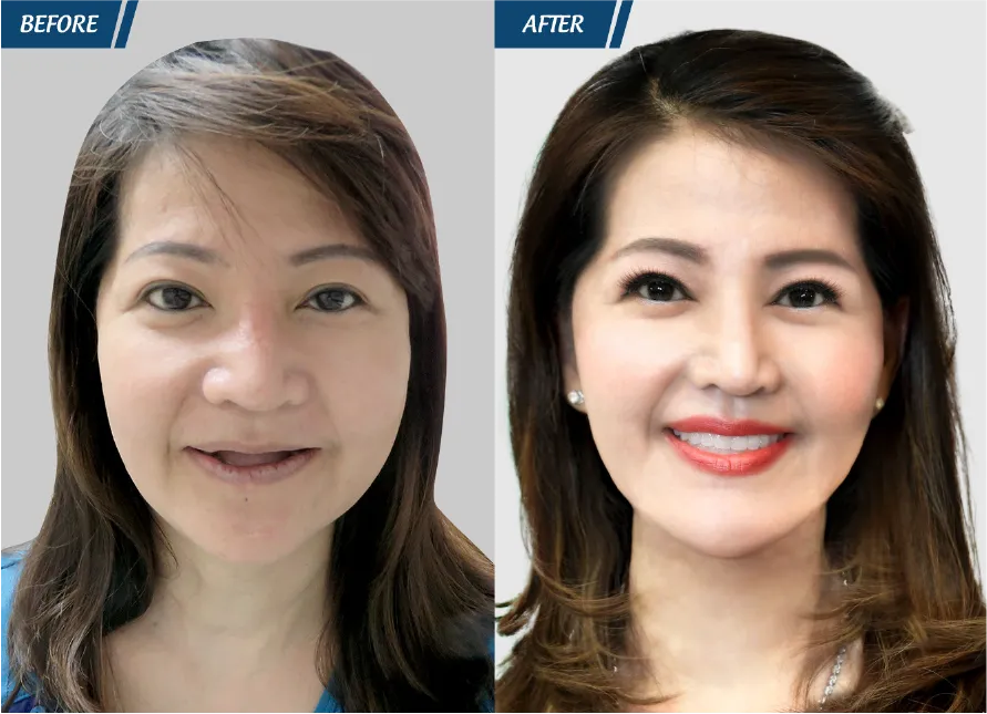 Răng Đẹp Đón Tết 2024