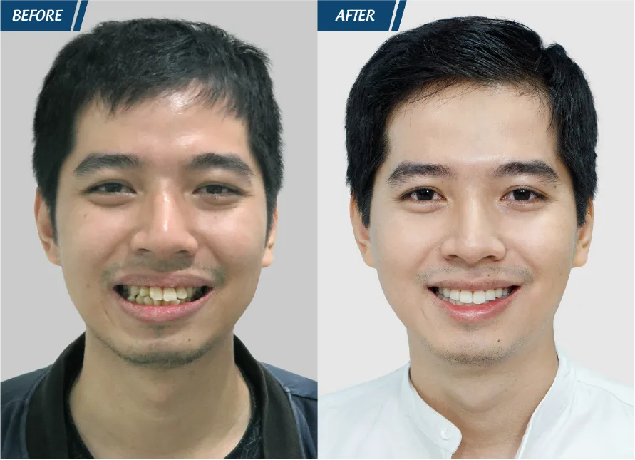 Răng Đẹp Đón Tết 2024