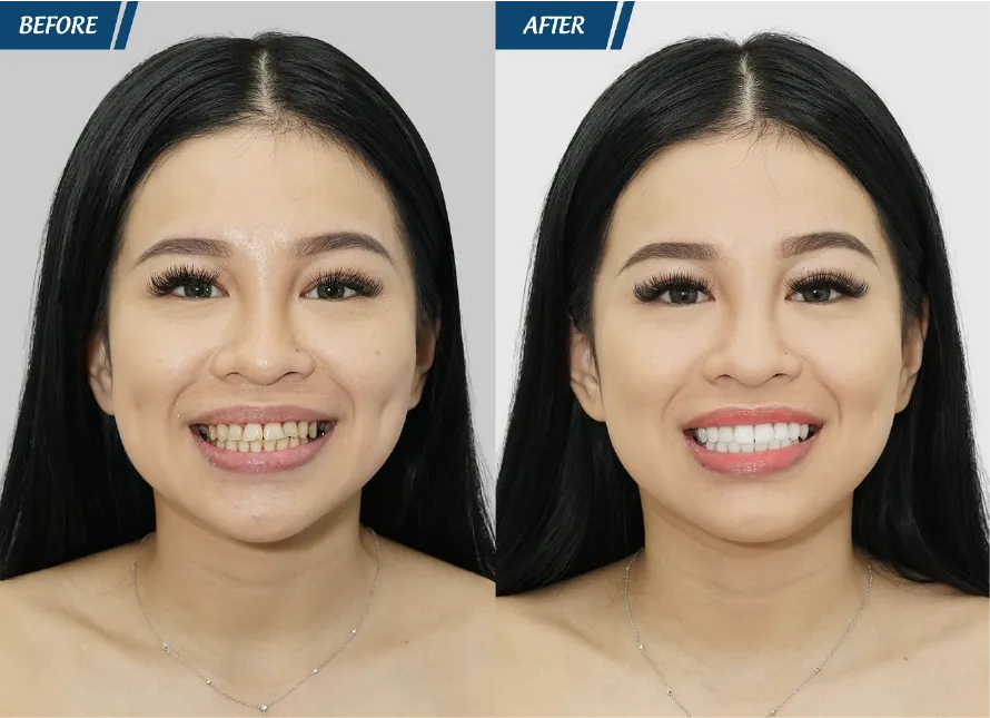 Răng Đẹp Đón Tết 2024