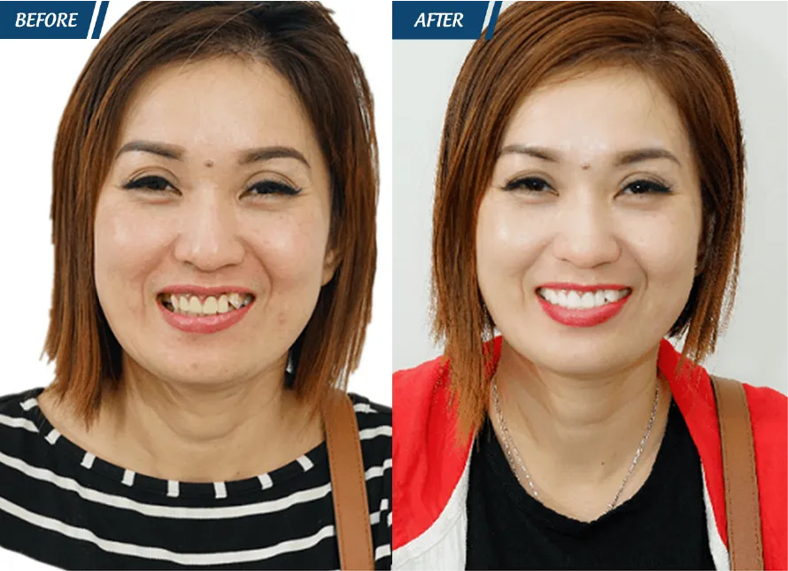 Răng Đẹp Đón Tết 2024