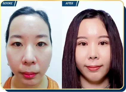 BẢNG GIÁ THẨM MỸ JW 2023