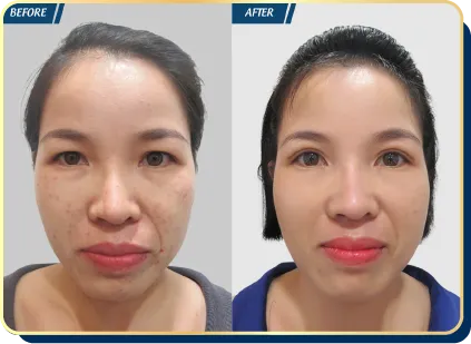 BẢNG GIÁ THẨM MỸ JW 2023