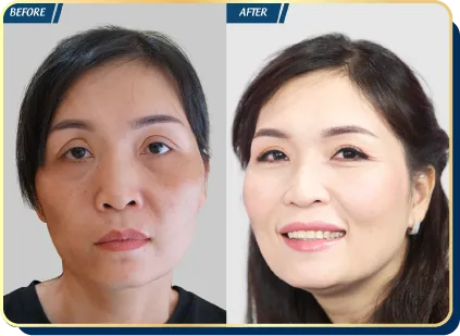 BẢNG GIÁ THẨM MỸ JW 2023