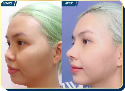 BẢNG GIÁ THẨM MỸ JW 2023