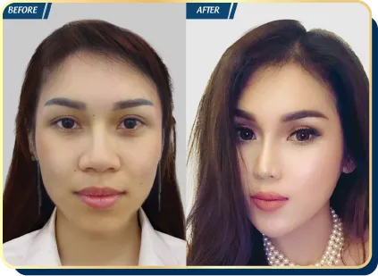 BẢNG GIÁ THẨM MỸ JW 2023