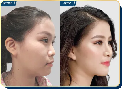 BẢNG GIÁ THẨM MỸ JW 2023