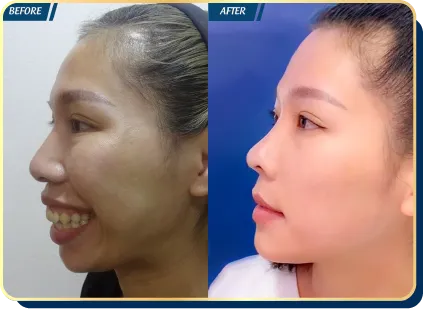 BẢNG GIÁ THẨM MỸ JW 2023