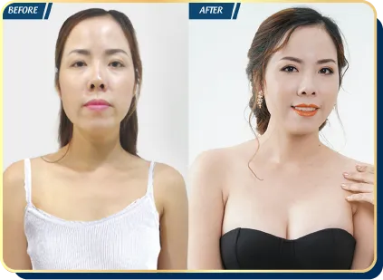 BẢNG GIÁ THẨM MỸ JW 2023