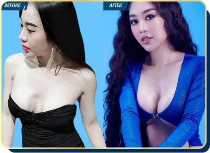 BẢNG GIÁ THẨM MỸ JW 2023