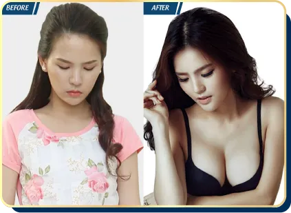 BẢNG GIÁ THẨM MỸ JW 2023