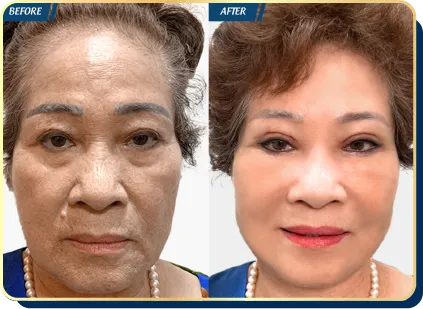 BẢNG GIÁ THẨM MỸ JW 2023