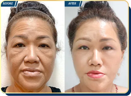 BẢNG GIÁ THẨM MỸ JW 2023