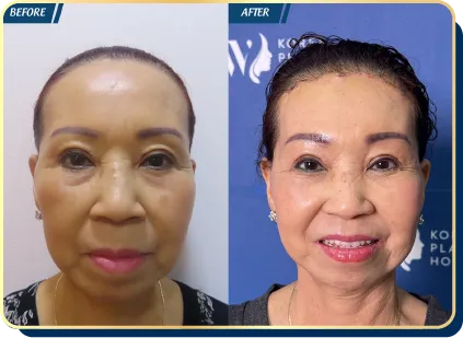 BẢNG GIÁ THẨM MỸ JW 2023