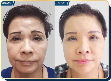 BẢNG GIÁ THẨM MỸ JW 2023