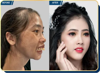 BẢNG GIÁ THẨM MỸ JW 2023