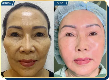 BẢNG GIÁ THẨM MỸ JW 2023