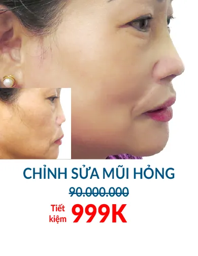 BẢNG GIÁ THẨM MỸ JW 2023