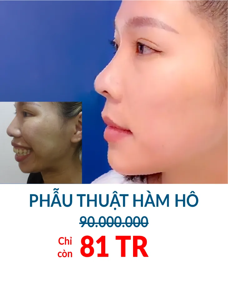 BẢNG GIÁ THẨM MỸ JW 2023