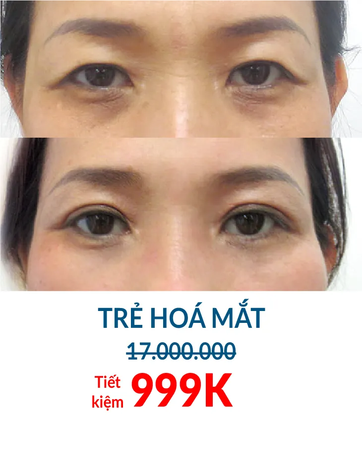 BẢNG GIÁ THẨM MỸ JW 2023