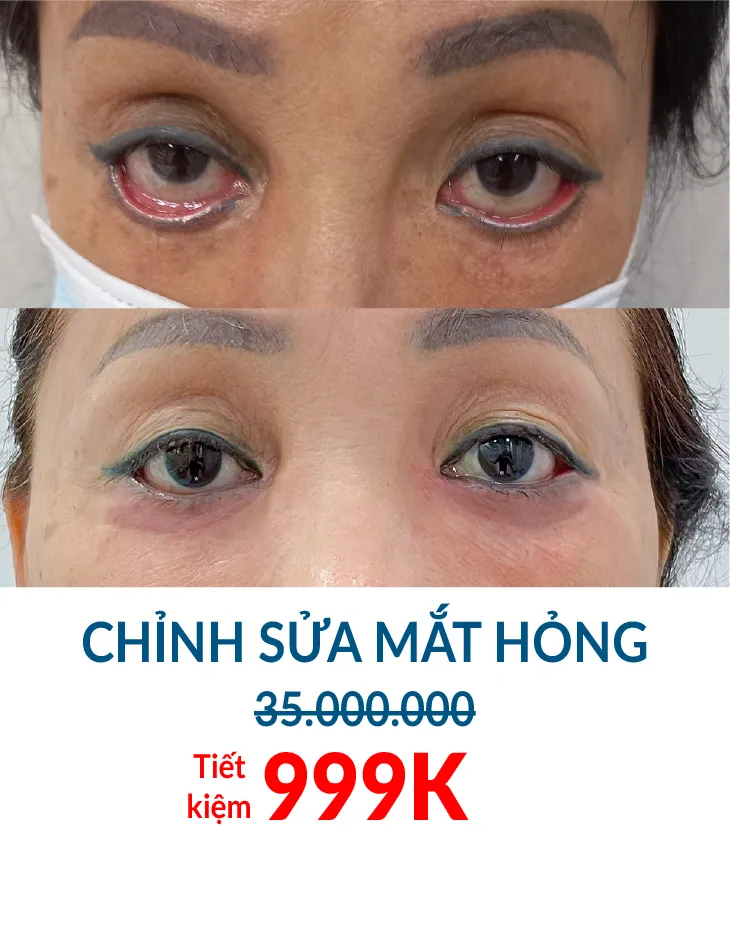 BẢNG GIÁ THẨM MỸ JW 2023