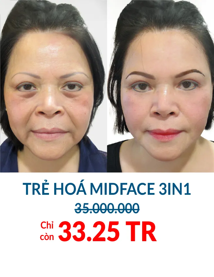 BẢNG GIÁ THẨM MỸ JW 2023