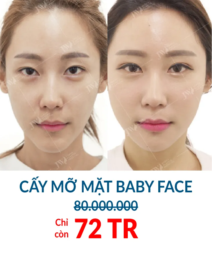 BẢNG GIÁ THẨM MỸ JW 2023