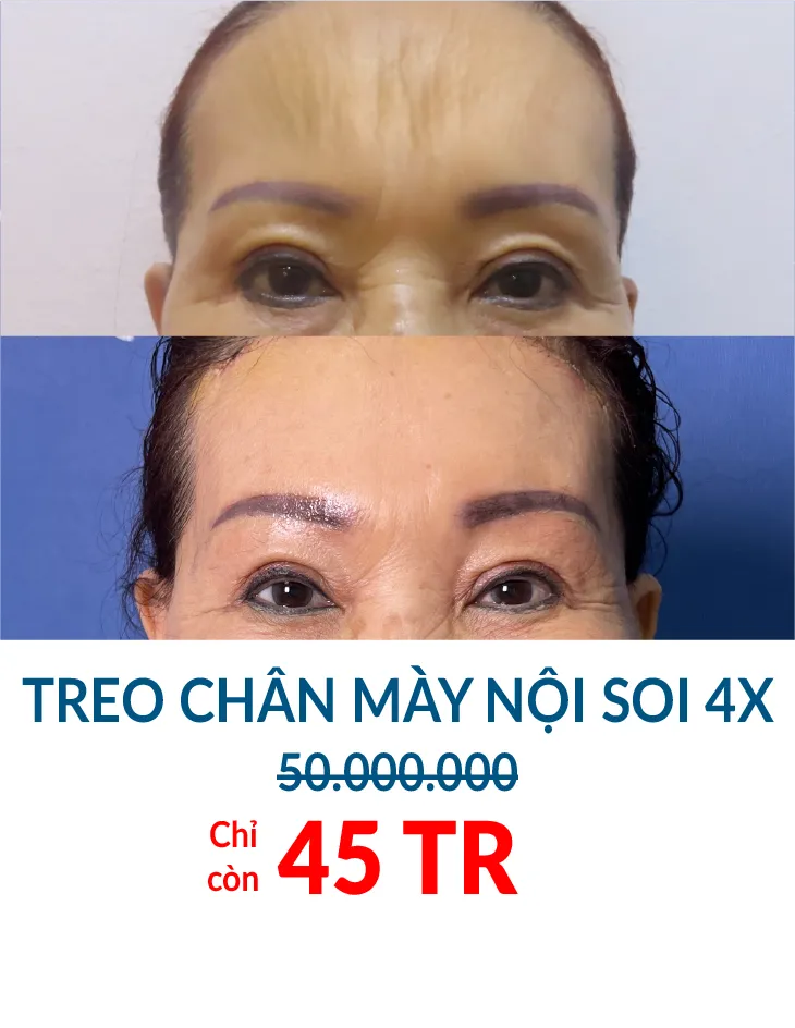 BẢNG GIÁ THẨM MỸ JW 2023