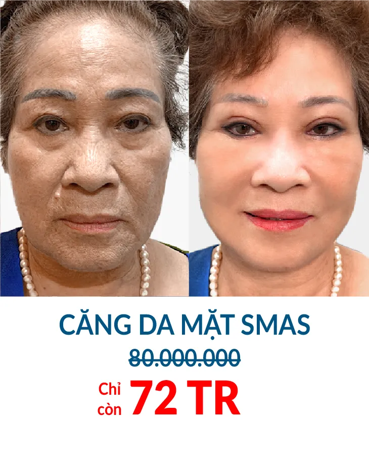 BẢNG GIÁ THẨM MỸ JW 2023