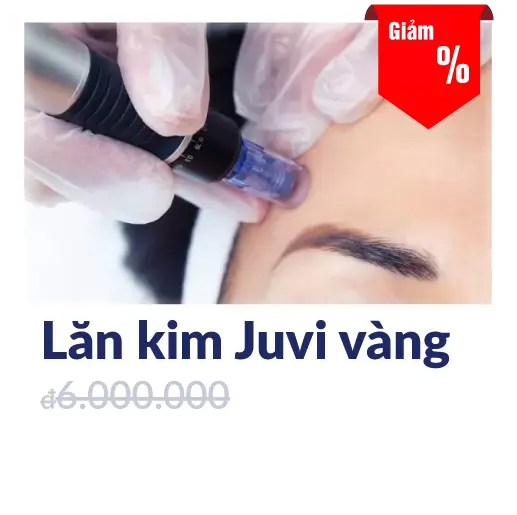 lang_kim_juvi_vang
