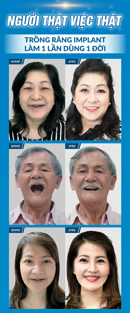 Làm Răng Đón Lễ