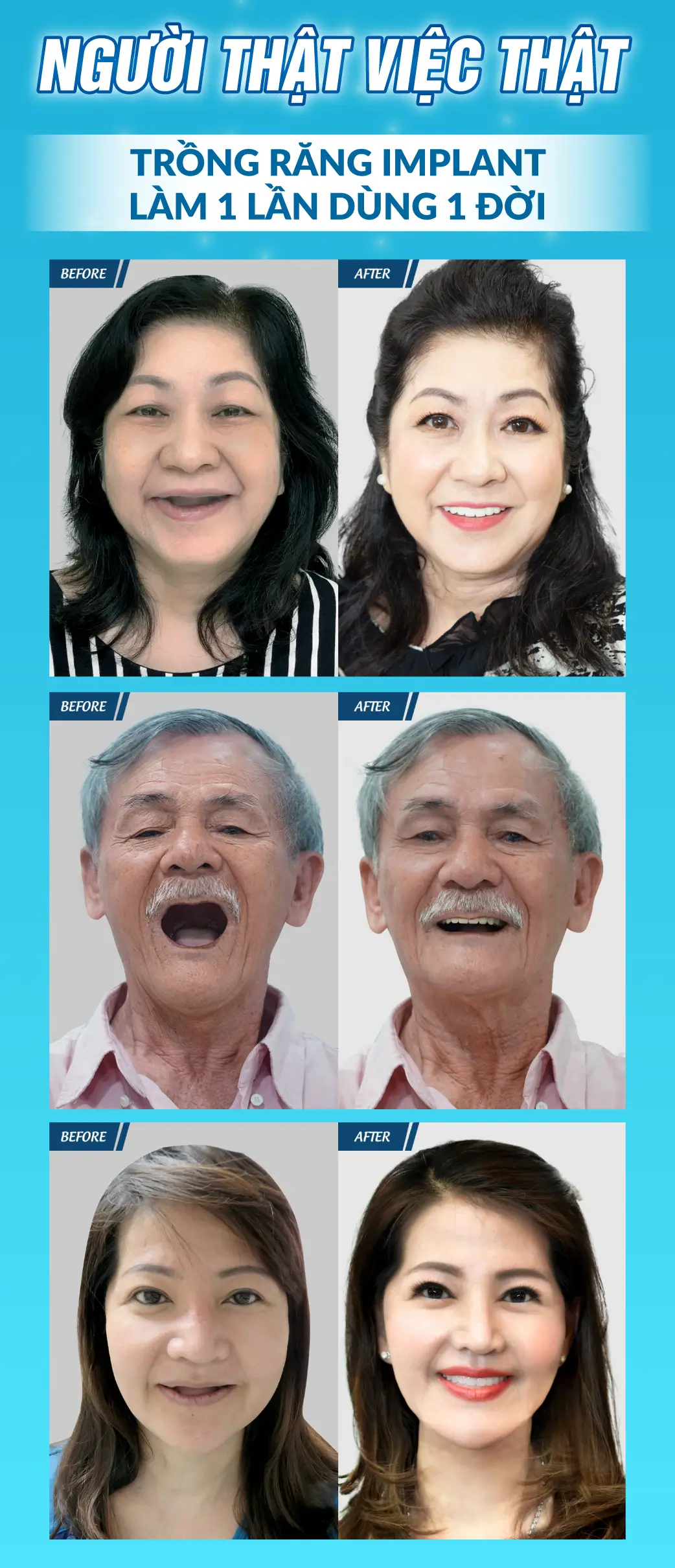 Làm Răng Đón Lễ