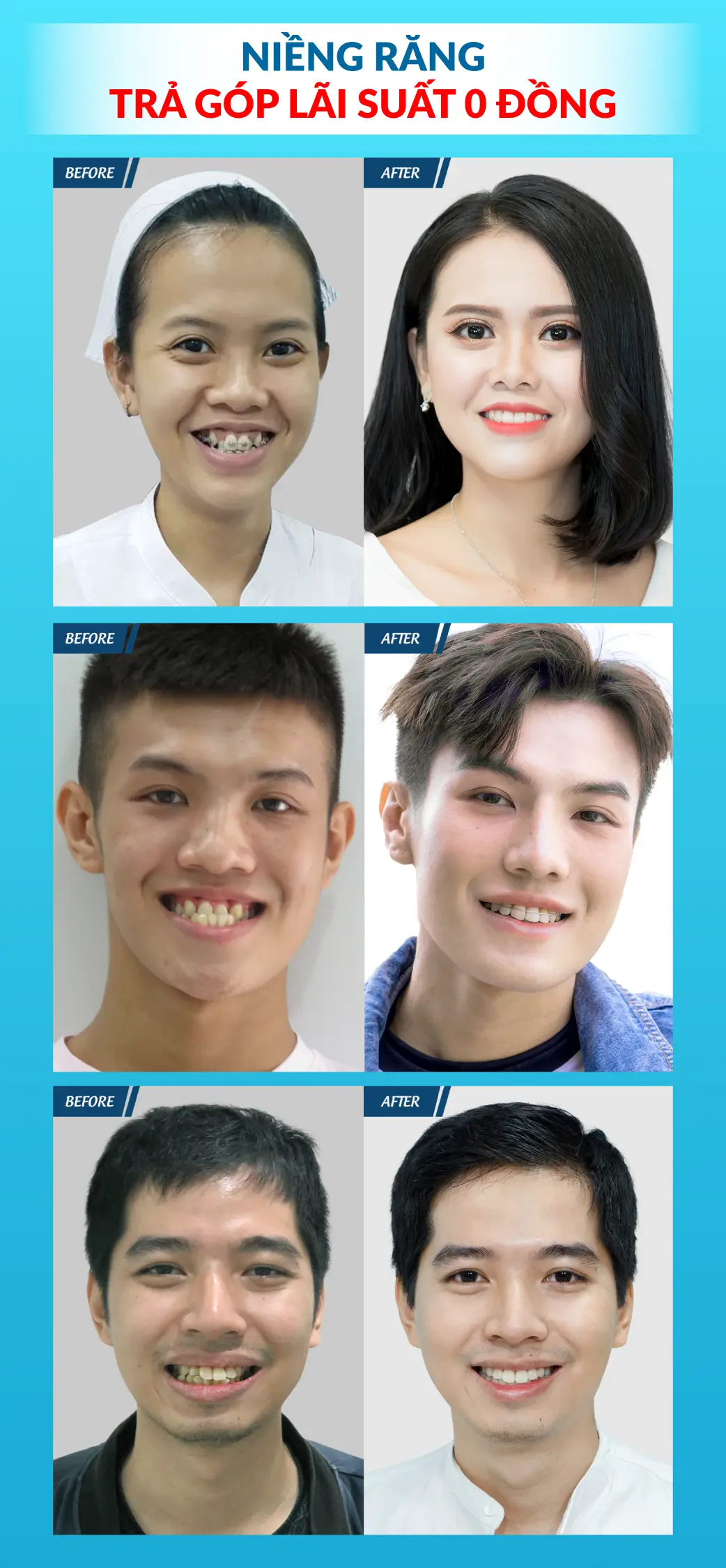 Làm Răng Đón Lễ