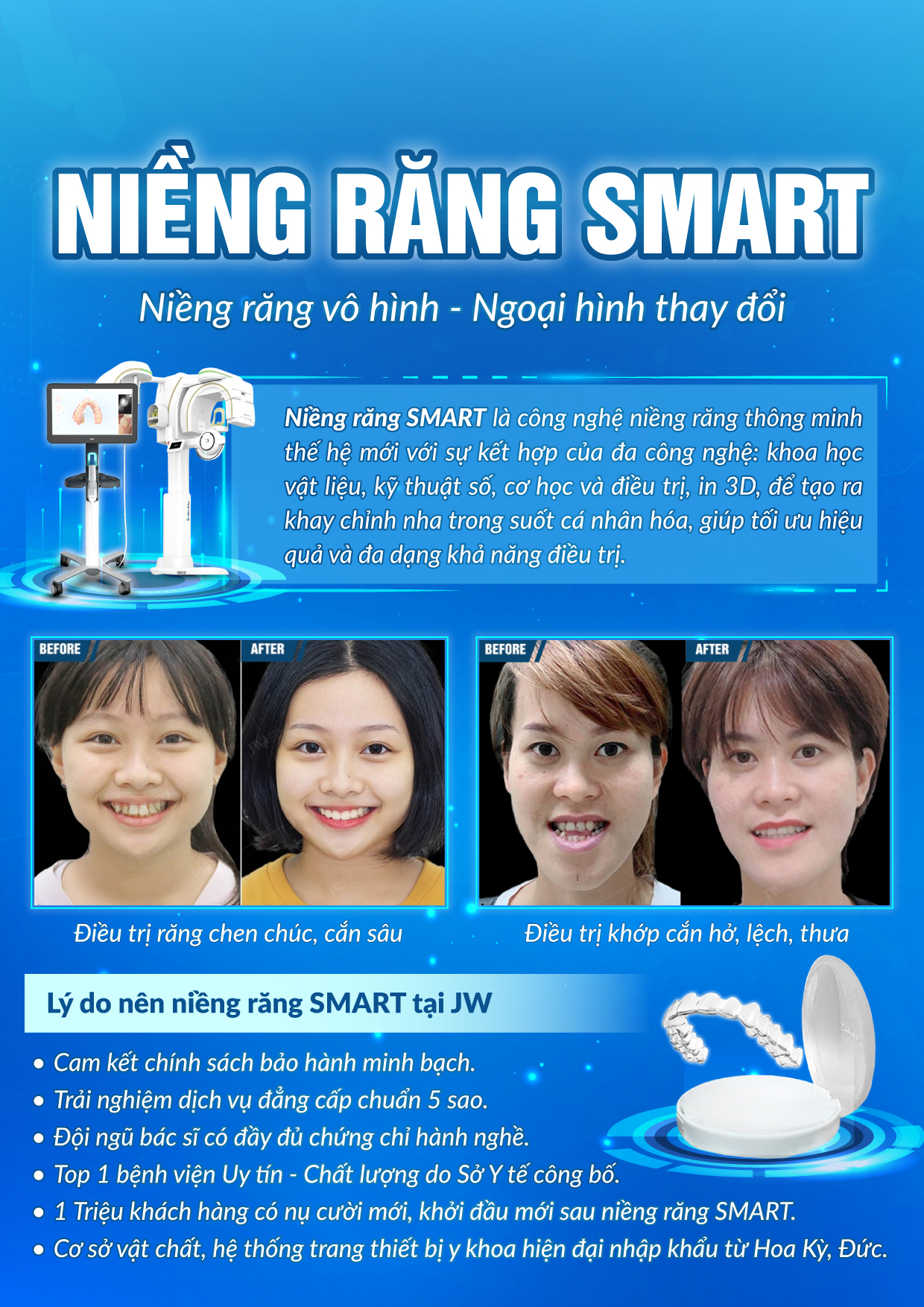Niền Răng Niềng Răng SMART