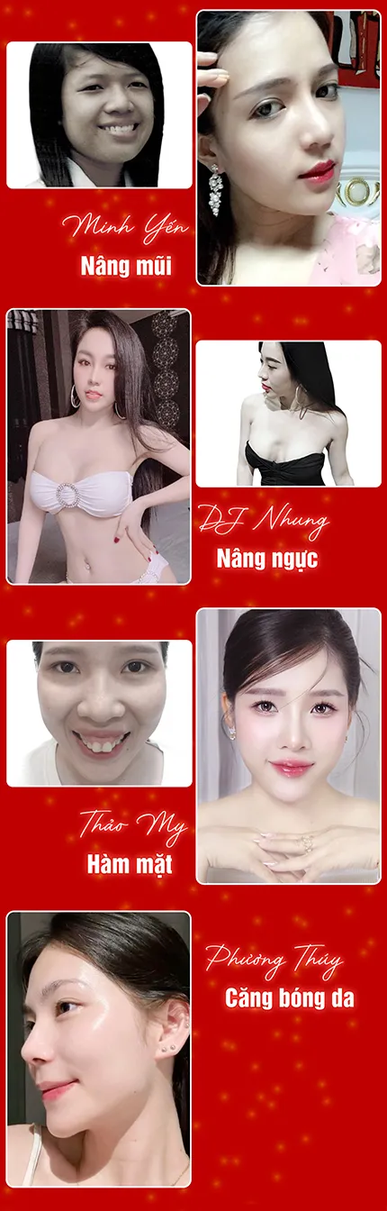 SIÊU ƯU ĐÃI THẨM MỸ