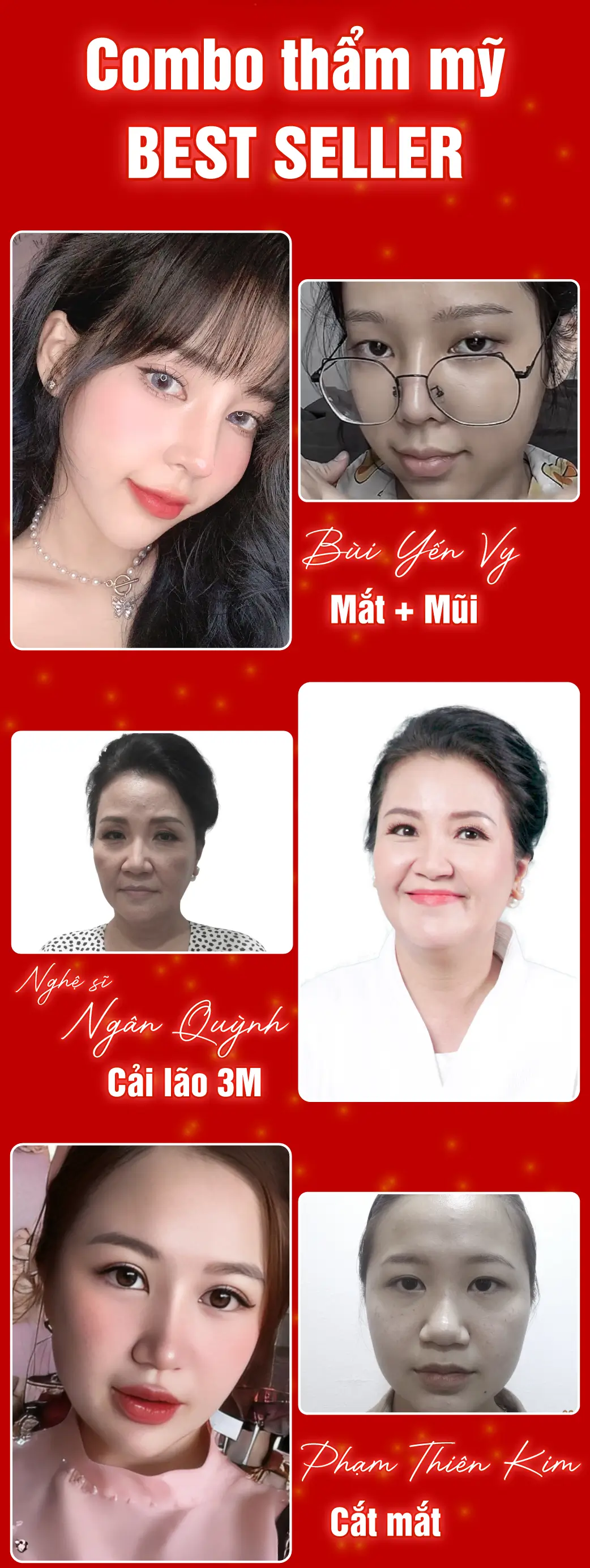 SIÊU ƯU ĐÃI THẨM MỸ