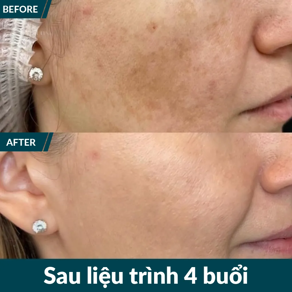 img-promotion-voucher