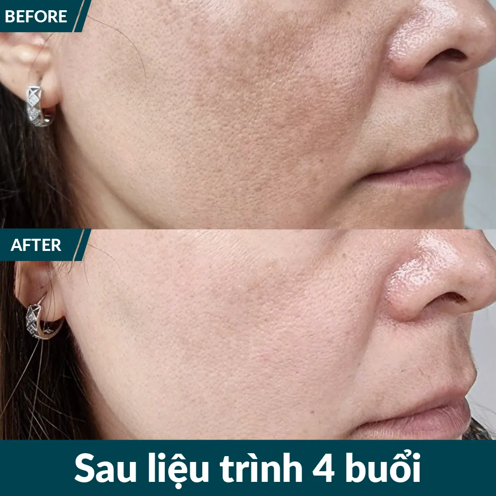 img-promotion-voucher