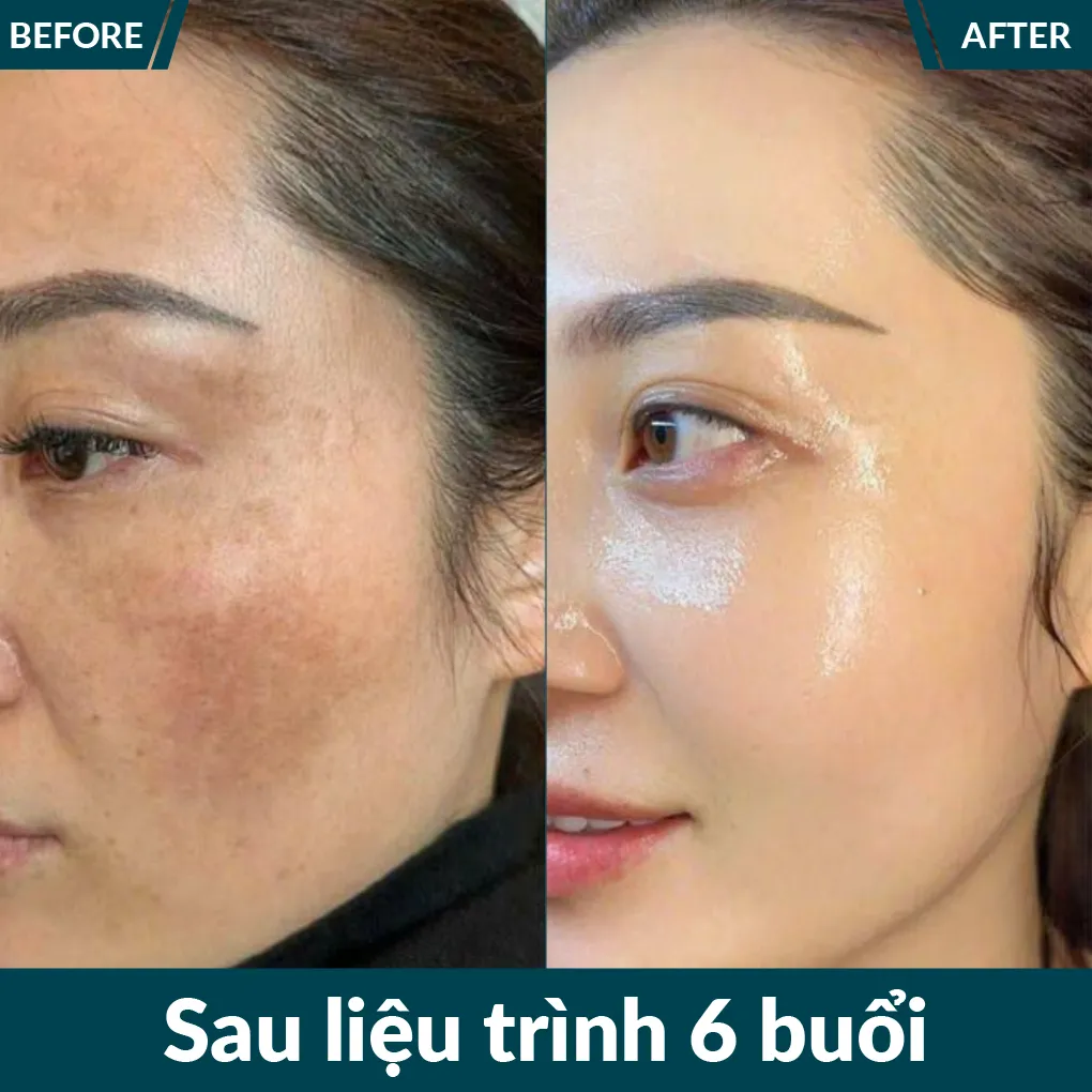 img-promotion-voucher