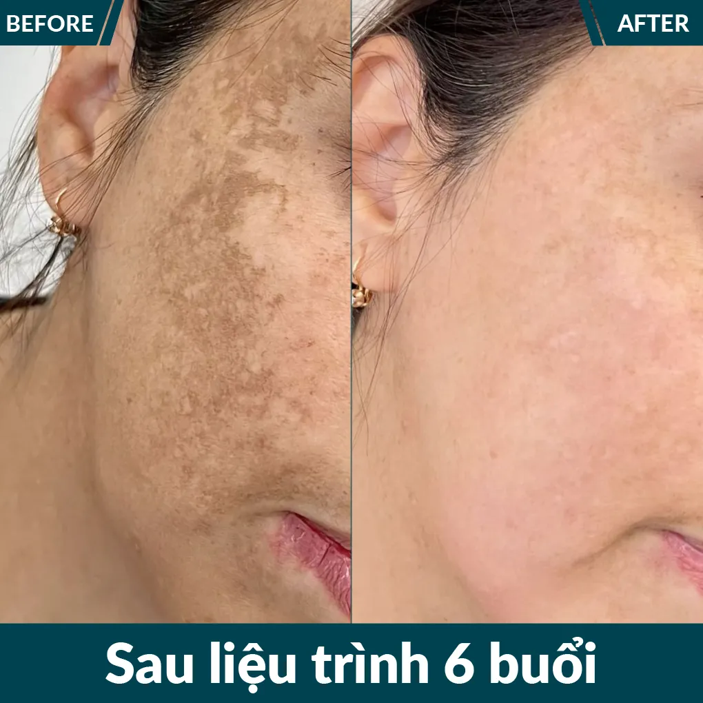 img-promotion-voucher