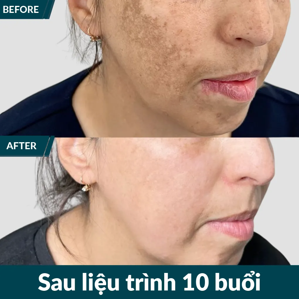 img-promotion-voucher