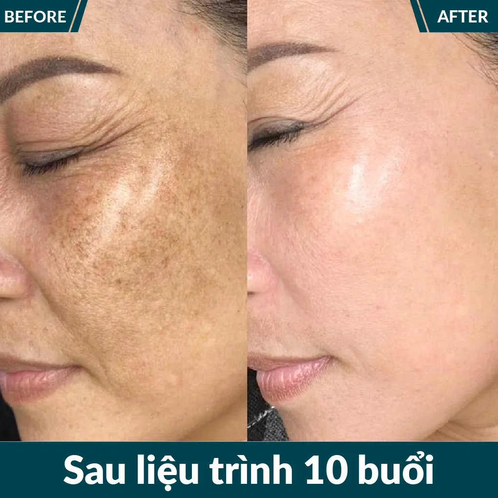 img-promotion-voucher