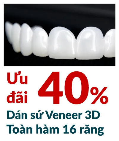 img-voucher-on-service-4